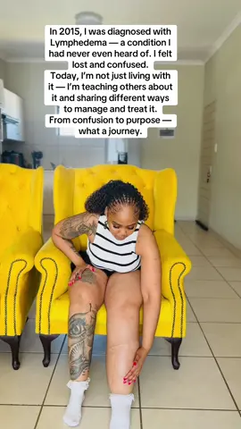 ⸻ Diagnosed with Lymphedema in 2015 — I had no idea what it was. Today, I’m educating others about it and sharing ways to manage and treat it. From confusion to purpose. #LymphedemaAwareness #RareButReal #LivingWithLymphedema #HealingJourney