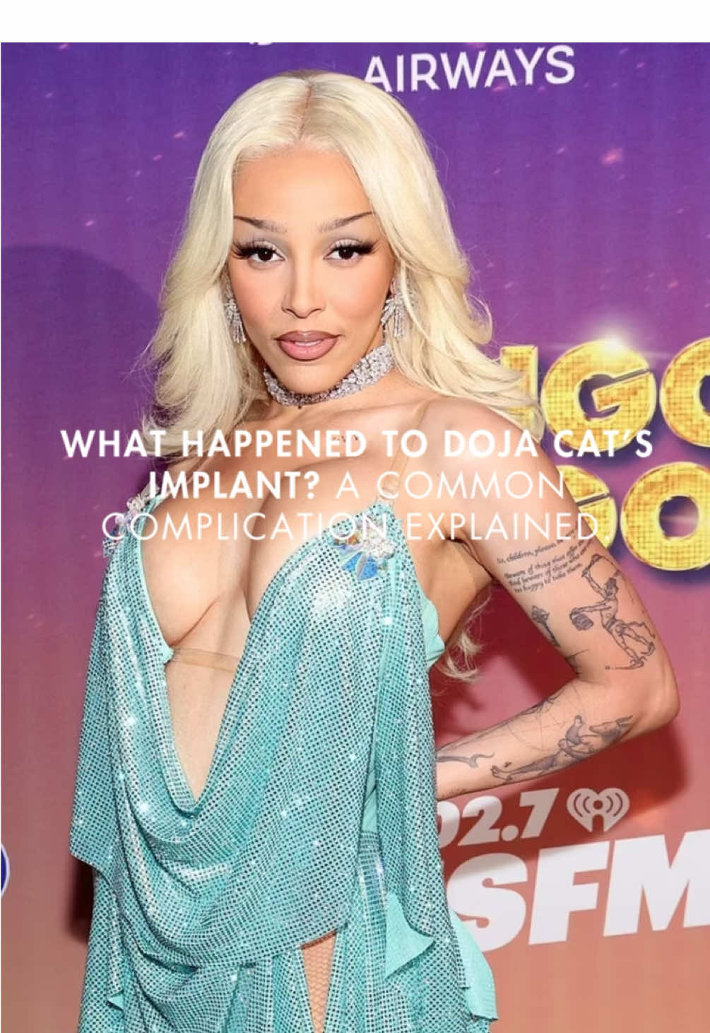 Capsular contracture is one of the most common—and emotionally challenging—complications after breast augmentation. Doja Cat recently opened up about her experience, shedding light on a condition many people are unaware of. #DojaCat #DojaCatEdit #WangoTango #BreastAug #BreastAugmentation #PlasticSurgeon #PlasticSurgery #CelebrityBeauty 