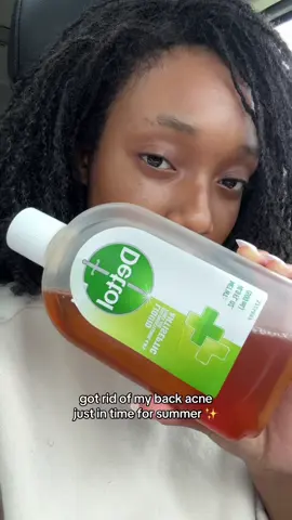 if your back still looks like a cheese pizza, this’ll get you right 😙✨ get u one so u can finally wear that backless dress this summer! #dettol #dettolantisepticliquid #bodycareessentials #fyppp 