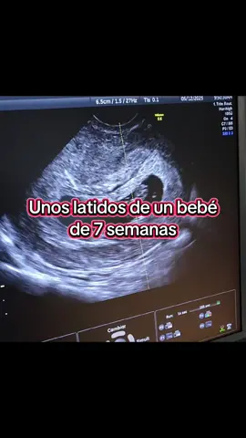 No hay mejor sensación que ver el rostro de una madre iluminarse al escuchar por primera vez los latidos de su bebé. Es en ese instante donde la vida, la ciencia y el amor se encuentran. Ser parte de ese momento… es un privilegio que solo la medicina me ha dado #obstetricia #bebe #pregnant #bebestiktoks 
