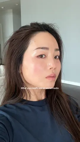 No filter no makeup, real skin🙌 filmed in the worst lighting😂😭#realskin #nofilter #upclose #skintok #pores #finelines #skinfluencer 