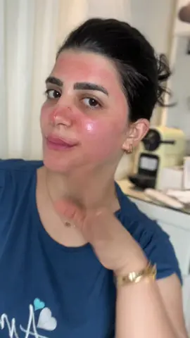 ديرما بن من غير بنج #skincare #beauty #makeup #dermapen #skinbooster #vigor #christena_sameh_makeup_artist #professional_makeupartist 