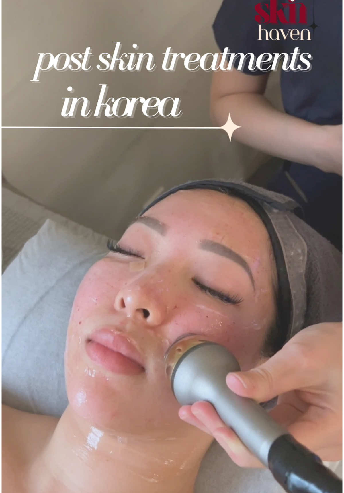 ✨ Just finished some incredible skin treatments in Korea 🇰🇷 — where advanced skincare meets flawless results! 💉💖 The healing process has begun, and I’m already seeing improvements in texture, tone, and glow. Can’t wait to share the journey and results with you! - #KBeauty #SkinBoosterGlow #HealingSkinJourney #KoreanSkincareMagic #GlowWithConfidence #HealthySkinJourney #antiagingtreatment #microneedling #skinsmart #skintips #facialistnearme #skincaretreatment #surreyfacials #burnabyfacials #vancouverfacials #antiagingtreatment #glowingskin 