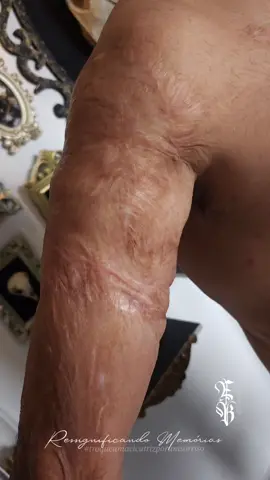 Marque alguém que precisa ver essa transformação  #tattoo #tatuagem #tatuagemcicatriz #coberturadecicatriztattoo #coberturadecicatriz #scartattoocoverup #scartattoo #cicatriz #cicatrices #scars #burnsurvivor #burnscars #queimadura 