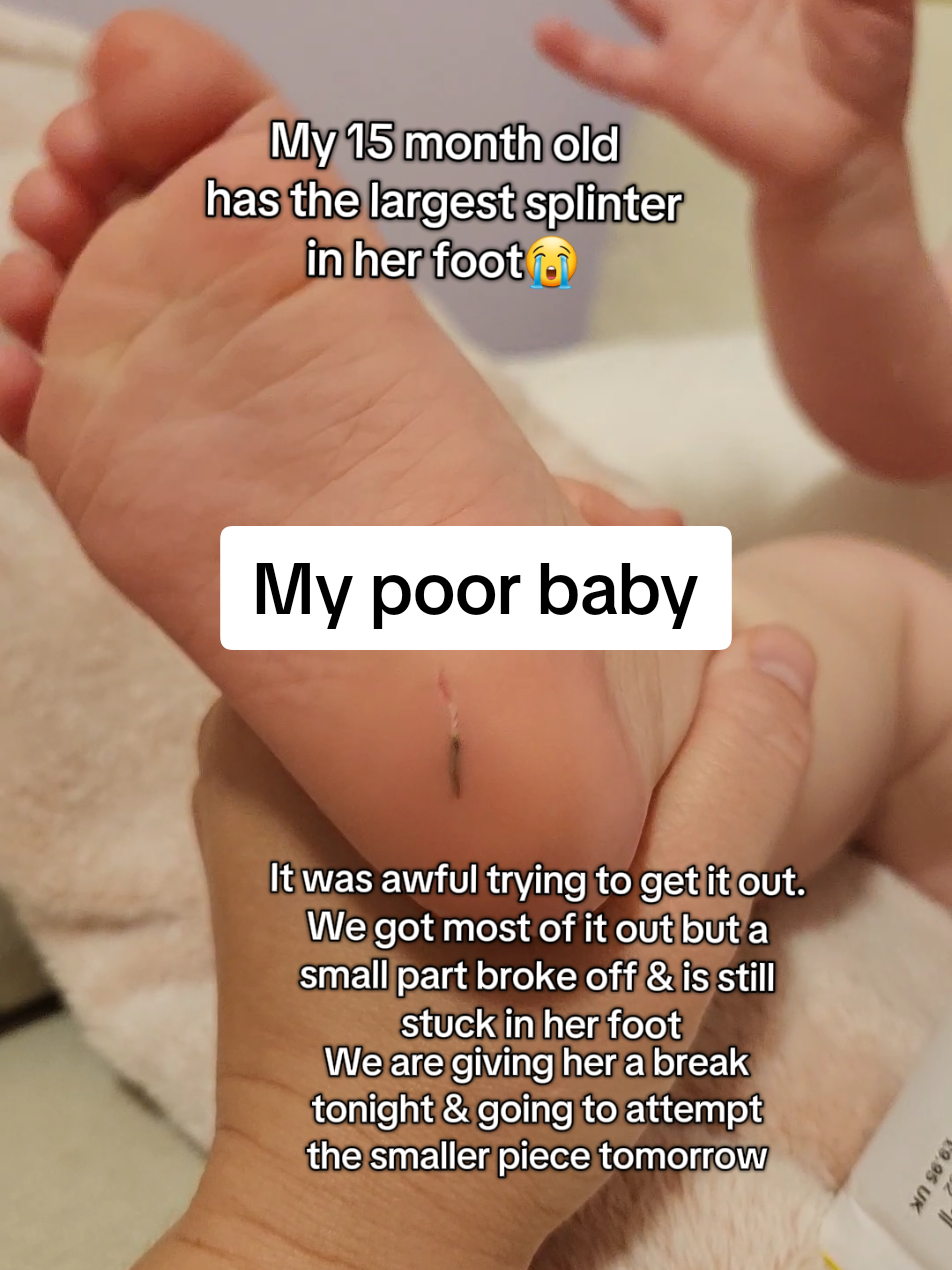My poor girl got the largest splinter😭 we did our best to get it all out but it was awful doing it & a little bit broke off & is still stuck in her foot. It breaks my heart when they don't understand what's happening & they are in pain & just looking to us to make it better. We are giving her a break tonight & going to attempt to get the rest out tomorrow. #momlife #toddlermom 