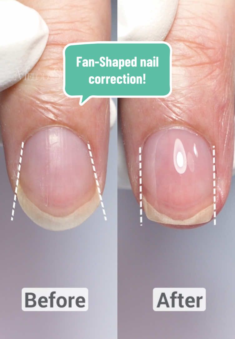 Fan-Shaped nail correction! 👉 Follow us for more tutorials! #melodysusie #melodysusienails #nailtools #nailart #nailchallenge #nailtutorial #nailtechlife #nailtechcheck #nailtechproblems #nailtechnician #nails #nailbeginner #nailpro #naillover #nailhack #nailtips #nailtip #naillamp #nailtok #nailsoftiktok 