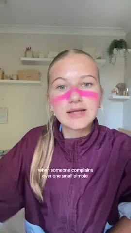 ignore the zinc I had a school carnival #fyp #pimple #zinc #ance #relatable #reposts #viralvideo 