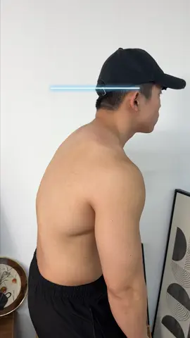 Soy una persona muy vaga，Hay una manera de detenerme del jorobado.😢😢😢 #posturecorrection#Hunchback#healthylifestyle#posturecheck#backpainrelief#posturecorrection#fyp#posturecoach#tiktokmademebuyit#goodposture#fixyourposture