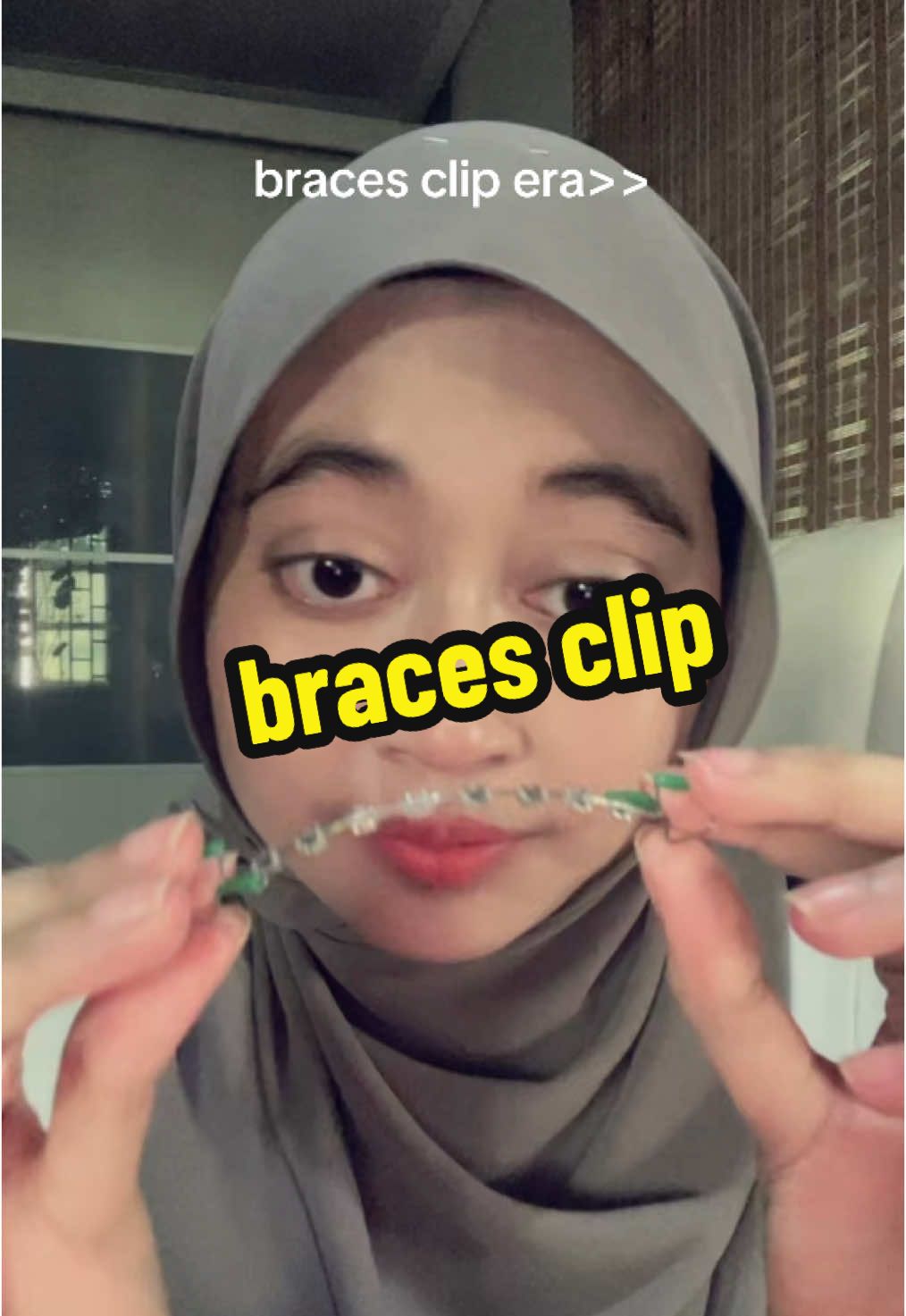 behel ada di keranjang kuning tapi di malaysia aja🙏🏼