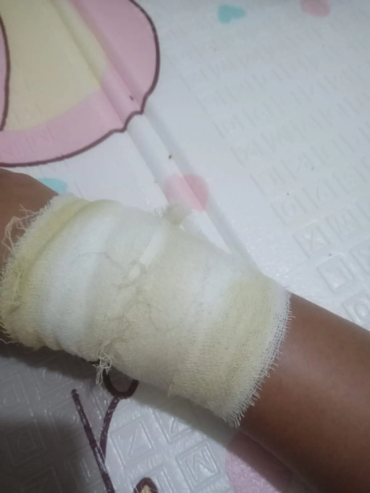 Akhirnya d perban juga tangan ni