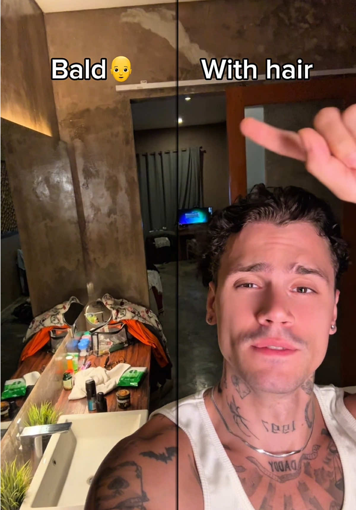 BALD VS WITH HAIR💀#shelove 