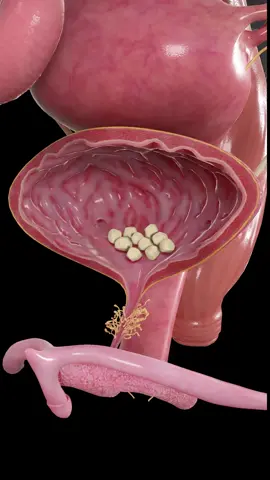 Bladder stones form when minerals in urine turn solid. This happens when the bladder doesn’t empty properly — often due to obstruction or chronic infection. They can stay silent or cause pain, blood in urine, or infections. This animation shows what they look like in 3D. Based on SciePro’s 3D anatomy model. Available for B2B licensing — link in bio. #science #medical #meded #3d #3dmodel #zbrush #sciart #medart #medstudent #anatomy #animation #scicomm #med #bladderstones #urology #urinarytract