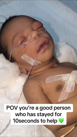 #foryoupage #prematurebaby #kindness #humanity #support #babytok #sickbaby#