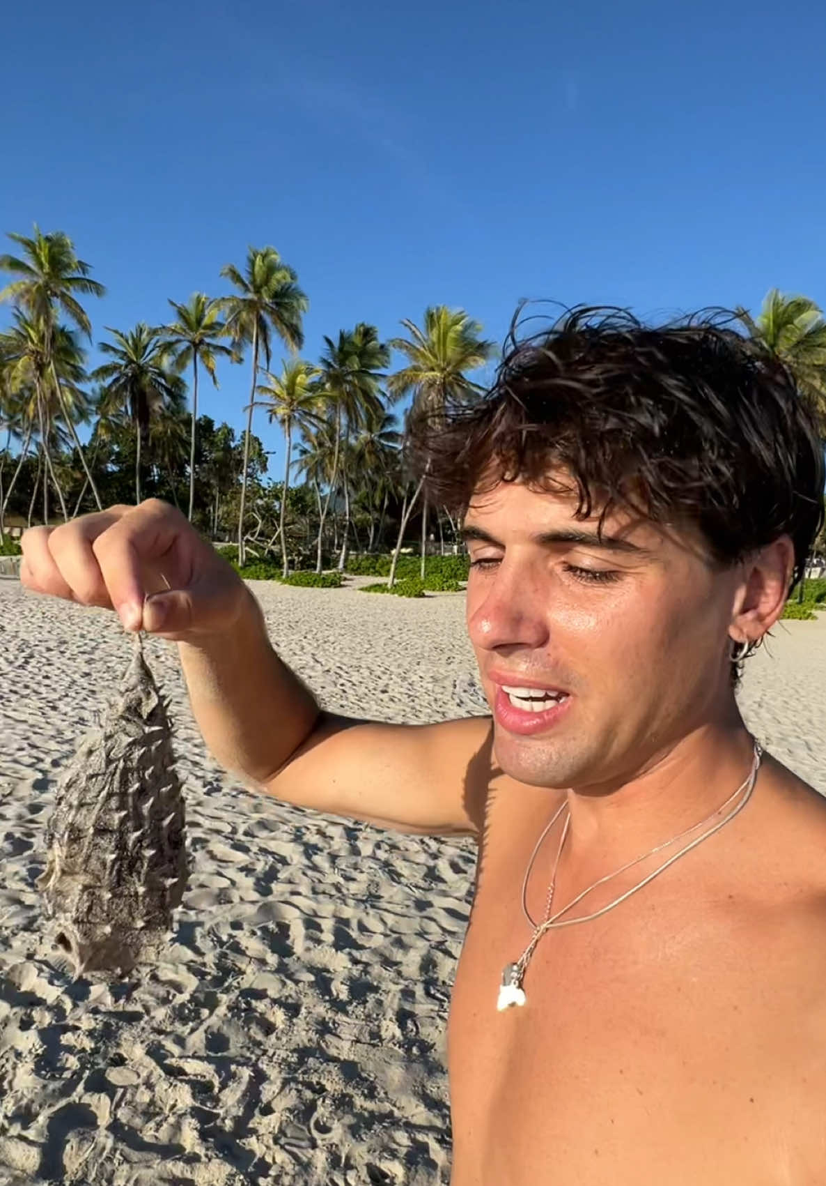 Bastante difícil y surrealista que te pueda pasar algo así, pero puedo confirmar que duele bastante 😮‍💨