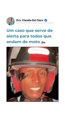 Recentemente, vimos um caso que serve de alerta para todos que andam de moto: um motociclista, com a viseira do capacete aberta, foi atingido no rosto por um morcego, chegando a encostar no olho. Felizmente, ele não teve consequências mais graves. Mas poderia ter sido diferente: lesões oculares, infecções e até riscos mais sérios podem ocorrer em situações como essa. Por isso, reforço: segurança em primeiro lugar! Ao pilotar, mantenha sempre a viseira fechada e utilize óculos de proteção quando necessário. Seus olhos agradecem e sua saúde também. Cuide da sua visão. Cuide de você. Créditos: @tatanoticias12 lá na rede vizinha 👩‍⚕️ Dra. Cláudia Del Claro | CRM: 10589 – RQE: 4834 Médica Oftalmologista