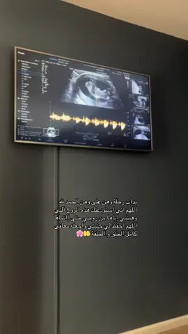 قولو ماشاءالله 🤲🤲