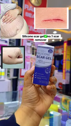 #ramlacosmetic #foryoupage #scargel #scar #eastleighcosmetic #eastleighcosmetic 
