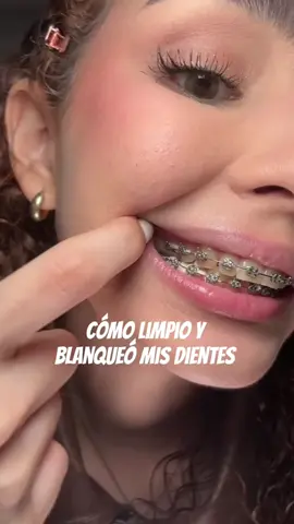 😲 ¿Quieres una limpieza dental de verdad? Con este combo 2×1 cepillo eléctrico + irrigador bucal eliminas placa, restos y bacterias en un solo ritual. ¡Tu boca nunca se sentirá tan fresca! ENLACE EN LA BIOGRAFIA DE MI CUENTA #ComboDental #CepilloEléctrico #IrrigadorBucal #HigieneOral #SaludDental #RutinaDental #CuidadoDiario