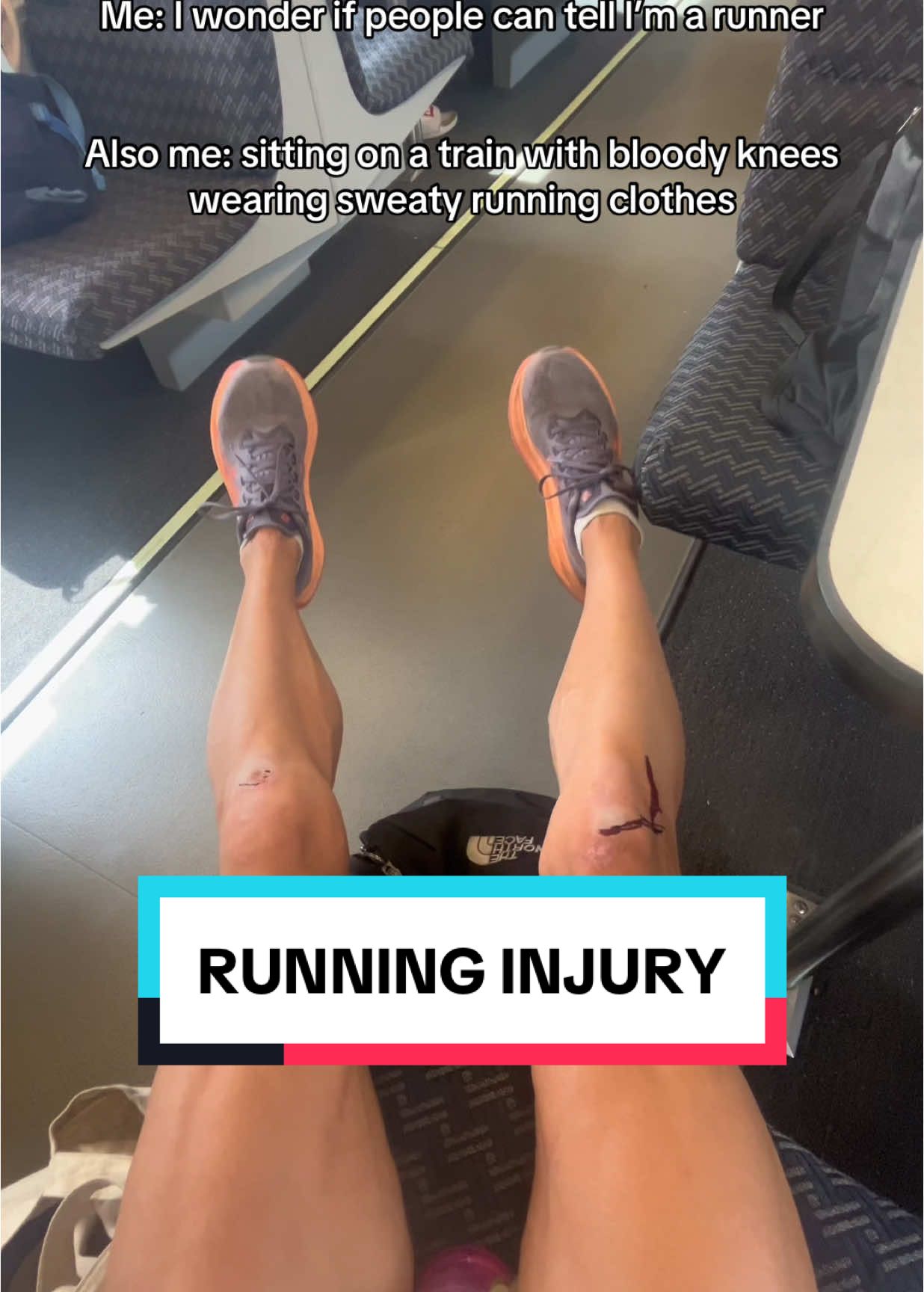 Faceplanted mid run and didn’t even notice I was bleeding until I sat down and people started staring. Ultra running is weird😅😅 #ultrarunner #runner #runnerinpublic #ultramarathon #marathontraining #runnerhumor #runtips #ultra #runlikeagirl #trailrunning #utahrun 
