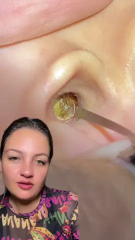 Me conte aqui de você está vendo esse vídeo ??? E quais tipos de vídeos vocês gostam ?? #terapia #reagindo #limpezasatisfatoria 