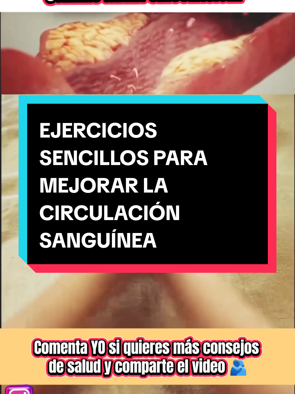 Ejercicios sencillos para mejorar la circulación y mantenerte joven, sabías que la mala circulación puede provocar vasos sanguíneos obstruidos, problemas de memoria, dolor de espalda, incluso problemas cardíacos.  Haz estos ejercicios todos los días durante un minuto y mejorarás la salud de tus vasos sanguíneos.  Comenta YO si quieres más consejos de salud y comparte el video.  IG reflexoterapiamilenaria  #acupuncture #ejercicios #ejercicioencasa #vasossanguíneos #dolordeespalda #malacirculacion #circulacionsanguinea #problemascardiacos #dolor #saludnatural #automasaje #automassage #terapiasholisticas #terapiasalternativas #terapiasalternativas #massage #massagetherapy #saludybienestar #medicinachina #terapiasnaturales #reiki #holistichealing #masajista #terapeuta #enfermera 