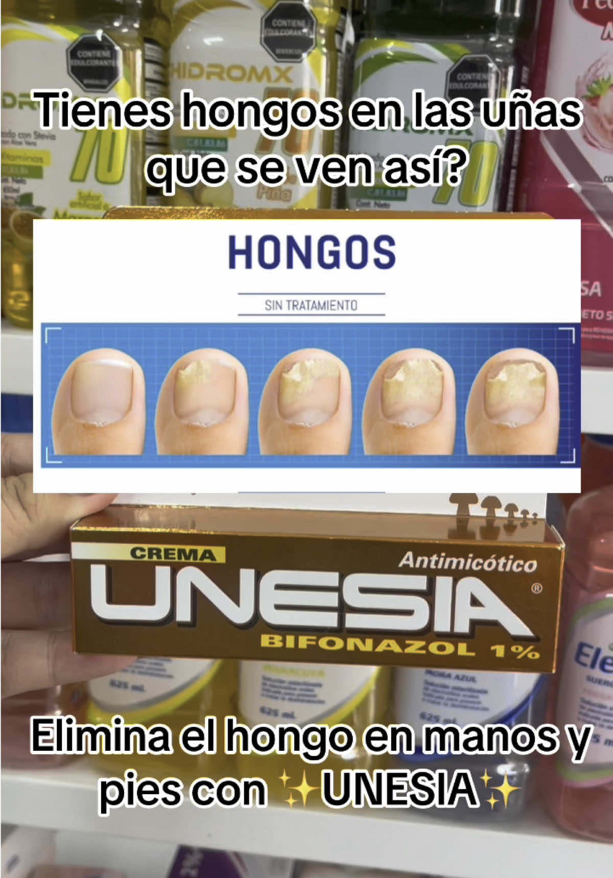 Tienes molestos hongos en las uñas y no sabes cómo aliviarlo?  Descuida, aquí te enseñamos cómo  #hongosenlasuñas #hongosenlospies #onicomicosis #salud #paratiiiiiii #fypppppp  ENCUENTRALO EN DROGUERIA PROMOLUZ 💙🤍⚕️ 🏨 CARRERA 11 #9-80 esq bajo el hotel zarzal  📍zarzal valle del cauca  Envíos nacionales🚚📦 🇨🇴Colombia  Escríbenos a wpp📱 https://wa.me/3157157576