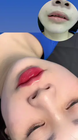Làm gì ai tin đây là môi của 1 người cơ chứ🤣. Qua em Linh sẽ không làm mọi người thất vọng đâu nha 😘😘 Liên Hệ với EM Linh để được tư vấn & đặt lịch (filler botox, chỉ xịn xò ạ / bao check tan, bảo hành 30 ngày sau tim) @345.028.503 (zl, sms) for booking Vinhomes ocean park - Gia Lâm, Ha Noi • NHẬN LÀM TẠI NHÀ •  #fullface #tiemmababy #tiemgọnhàm #tiemtai #thongonbaptay #thongonbapchan #thongonbavai #tiemmong #tiemhoinach #xoanhan 