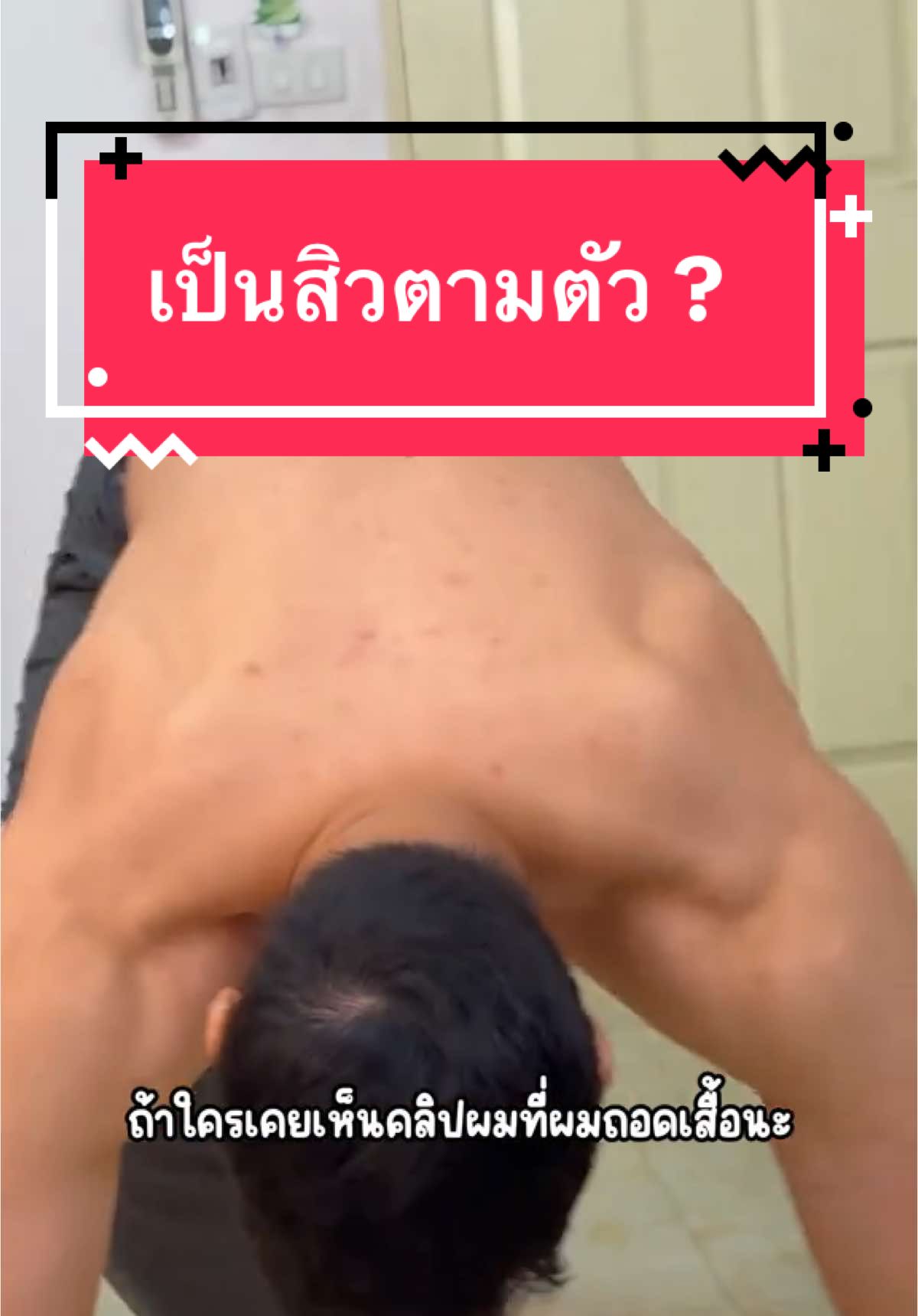 ใครที่เป็นสิวตามตัว หรือที่หลังผมแนะนำลองครีมอาบน้ำตัวนี้ดูนะครับ #ครีมอาบน้ำ #เดทตอลไม่หยุดทุกการปกป้อง #เดทตอลเจลอาบน้ํา #สิวที่หลัง #เป็นสิวที่หลังต้องทําไง #อาบน้ำ