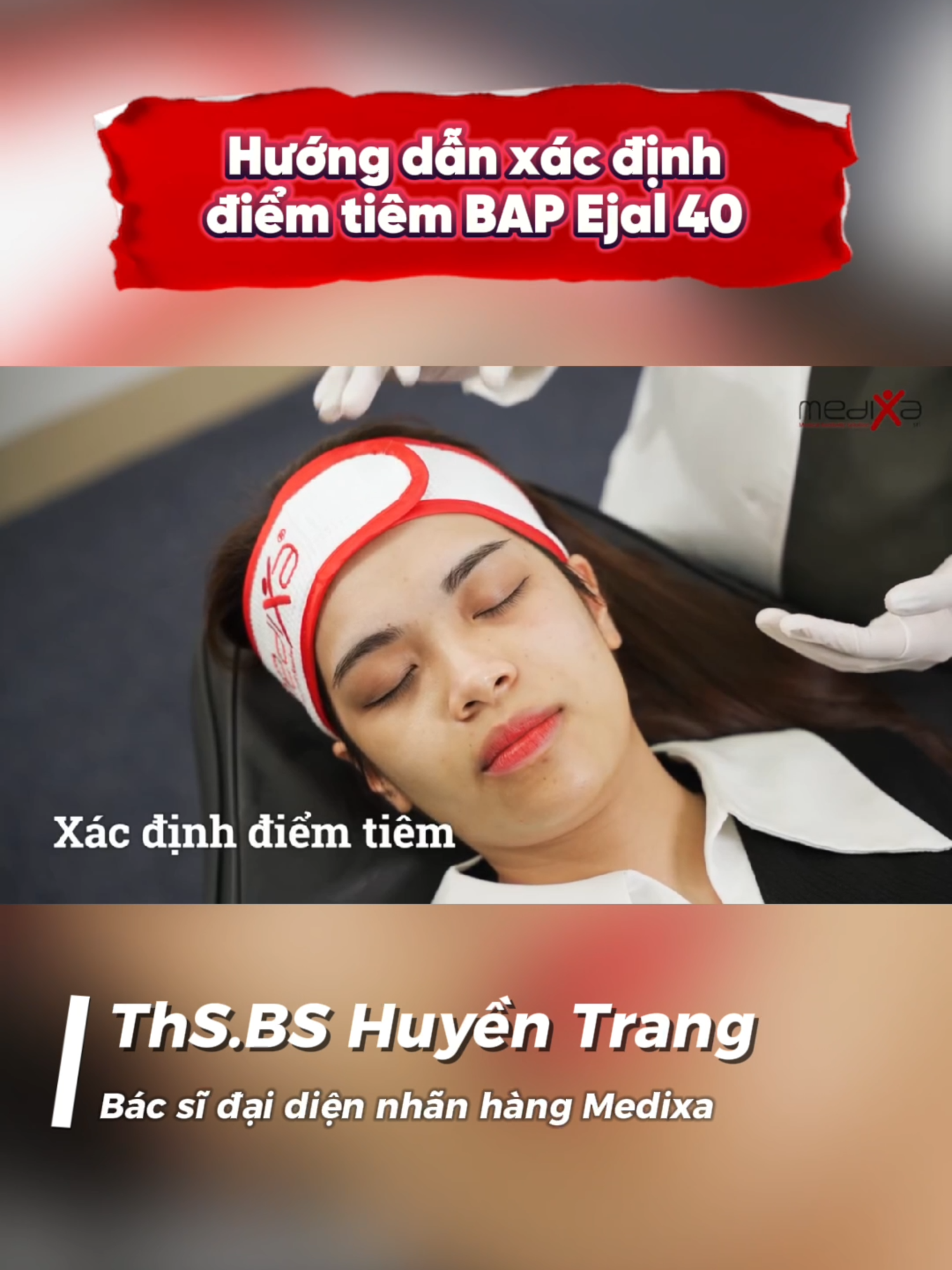 Hướng dẫn xác định điểm tiêm BAP Ejal 40 dành cho các spa, thẩm mỹ viện, clinic. Hướng dẫn được thực hiện bởi ThS BS - Chuyên gia thẩm mỹ da liễu Nguyễn Huyền Trang #ejal40 #medixa #tiemBAP #thammyvien #spa #dalieu #tiemmeso