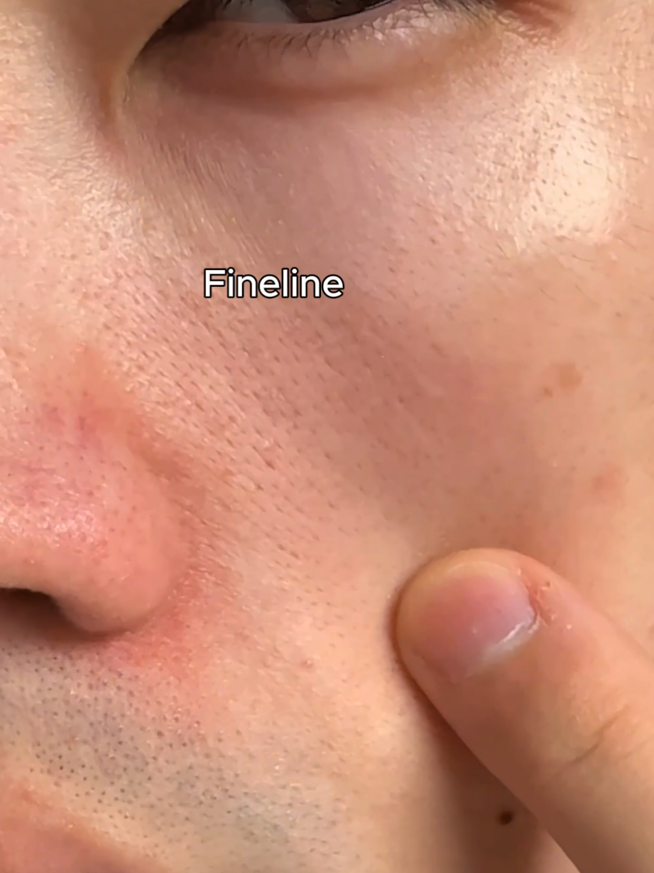 fine line? smile line? #collagen #serum #finelines #smilelines #wrinkles #orien  #skincare #kbeauty #7daysglow #7days #koreanskincare #skincareroutine #fineline #mugwort 