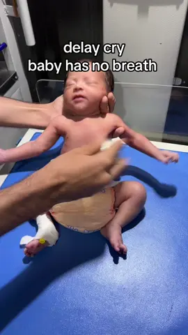 delay cry baby #baby has no breath #please pray for baby #newborn #nicubaby 