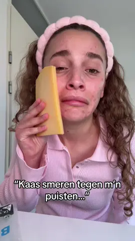 *Ad M’n gezicht stinkt nog steeds naar kaas😫 *Benzac 50mg/ml Gel is een geneesmiddel (benzoylperoxide). Lees voor het gebruik de bijsluiter. Wees bij gebruik van dit geneesmiddel voorzichtig in de zon, uv straling kan irritatie veroorzaken.’ @Benzac_nl #grappig #relatable #skincare #omg 