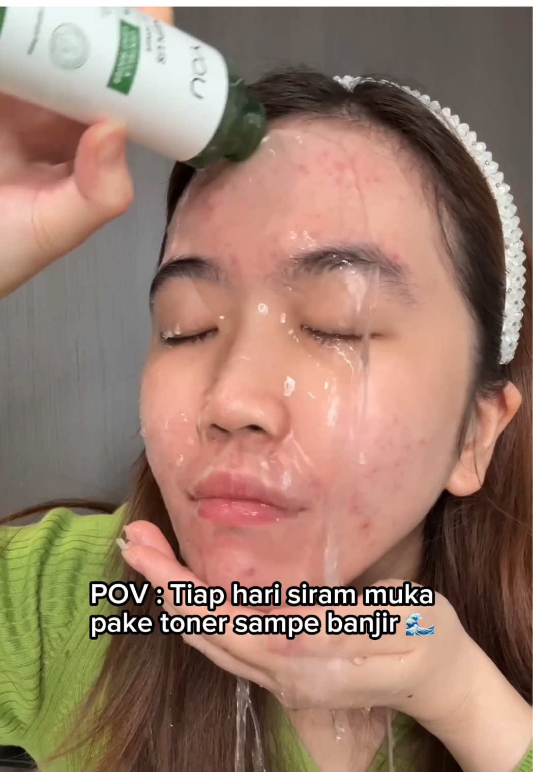 WAJIB PUNYA! Siram muka tiap hari pakai toner khusus buat jerawat! 😍✨ #toner #fyp #fypage #viral #skincare #skincaretips #pov 