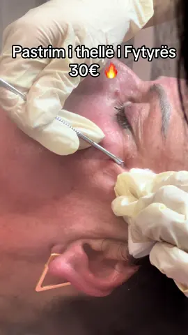 HydraFacial 🔥🔥 #skin #skincare #skincareviral #hydrafacial #hydrafacialtreatment #SelfCare #beauty #beautiful #girls #aesthetic #fyp #fypp #viralv #viralvideos #drenas #skenderaj #malisheva #gjakova #kosovo 