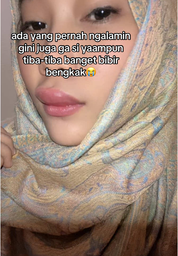 ini paling parah dari biasanya sih, alergi atau apa atau apaaaa😭