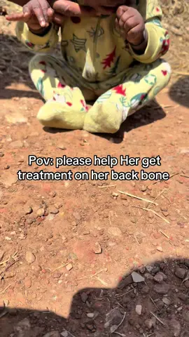 Link in the bio to help Nisha 🙏😭 #homelesskids #backbone #disabledkid #disability #surgery #parlayzed ##linkinthebio #foundation #orphan #amsr  