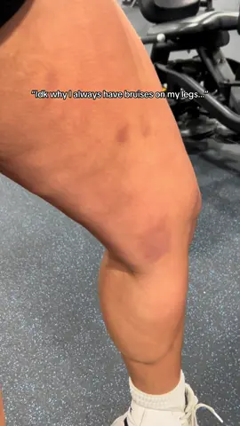 🤭🤭🤭 #legday #fyp #GymTok #bruises #gymcomedy #hipthrusts #quads 