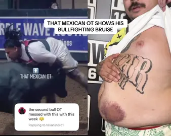 #ThatMexicanOT shows his crazy BULLFIGHTING bruise 🐂🤯 Listen to @Brown Bag Mornings on Power 106 wherever you listen to podcasts! 