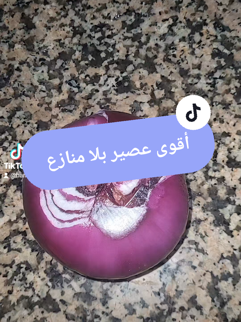 onion juice #الصدفية #psoriasis #علاج_طبيعي 