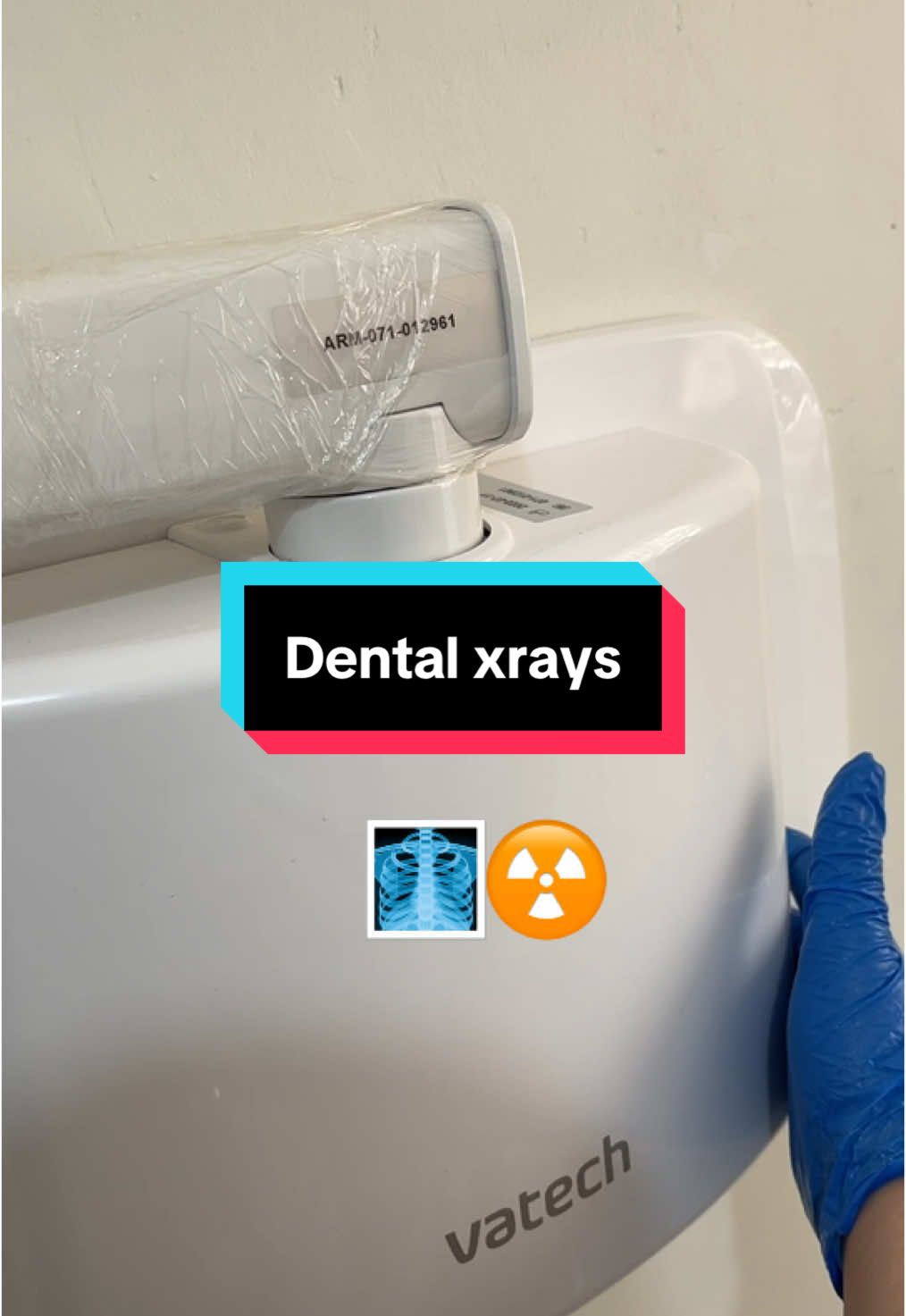 في عالم طب الأسنان، الأشعة مش مجرد صورة هي الصديق الوفي لطبيب الأسنان … هي الخريطة اللي تكشف لنا اللي ما تقدر العين تشوفه. سن شكله طبيعي؟ الأشعة تقول غير! ألم بسيط؟ يمكن تحته كيس أو خراج كبير! للذلك ،لا يوجد تشخيص دقيق بدون راديو. وإذا رفضت تاخذ أشعة، كأنك تقول للطبيب: ‘عالِجني… لكن غمّض عيونك’#حدي#حديث_مع_طبيبطب_#طب_الأسنان #طلاب_طب_اسنان أشع#أشعة_الأسنان#راديو_الأسنان #تثقتثقيف_طبي Den#dentistry #Denntalxray #Tooothfacts #تعليم_صحيح_في_مكان_الصحيح #تعليم_صحي #dentaltok#الجزائر🇩🇿 #الجزائر_تونس_المغرب #الجزائر🇩🇿_تونس🇹🇳_المغرب🇲🇦 