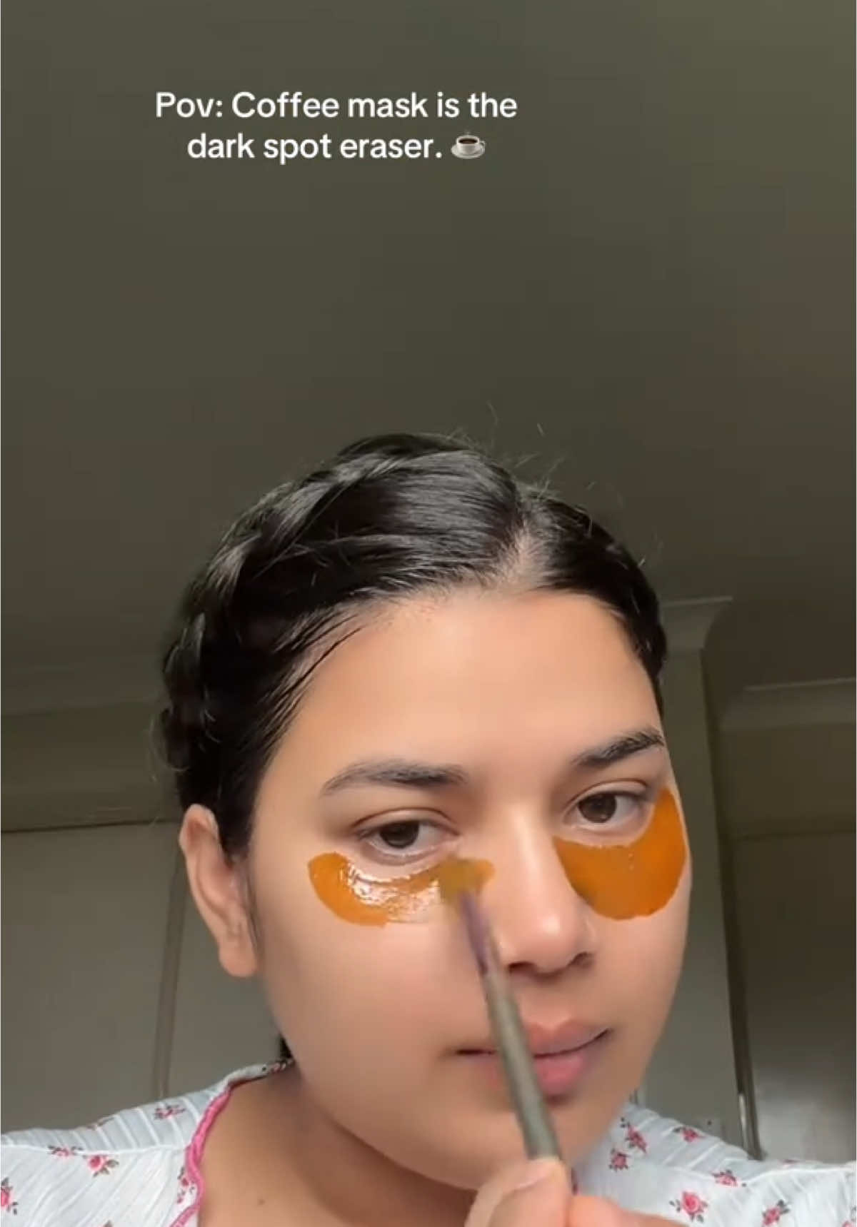 #dark #spots #aye#circles #fypシ゚viral🖤video #fypシ゚viral🖤video #1millionauditon #cap #cut #flying #fly #amiirabeauty7 
