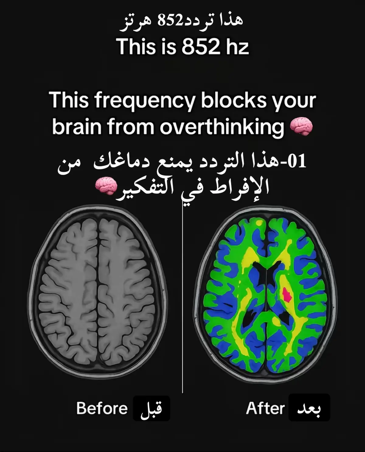 #mindset #mind #MentalHealth #fyp #explore #psychology #anxiety #relaxing 