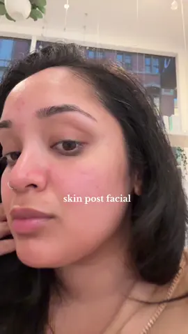 My makeup is about to EAT with this skin #facialtreatment #facial #skincare #skintreatment #newyork #skinprep #makeup #beautyhacks 
