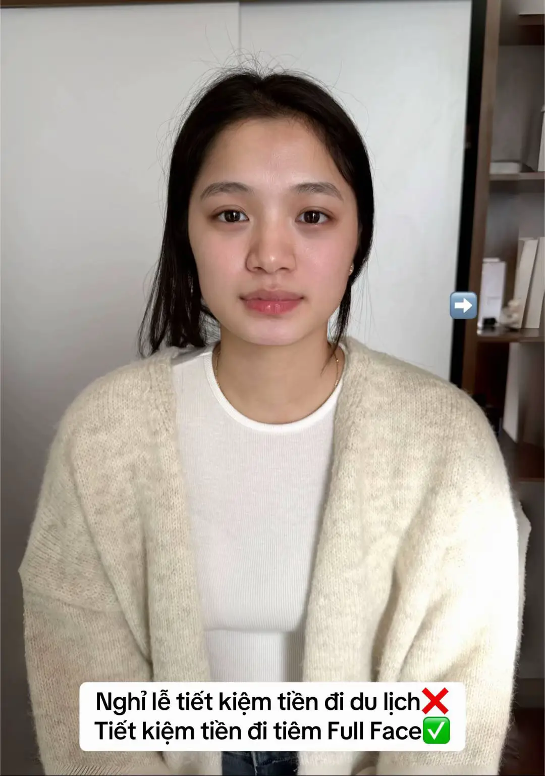 Case căn chỉnh full face kỹ thuật nâng tầng mặt giữa MD Codes kết hợp domino with HA #xuhuongtiktok 