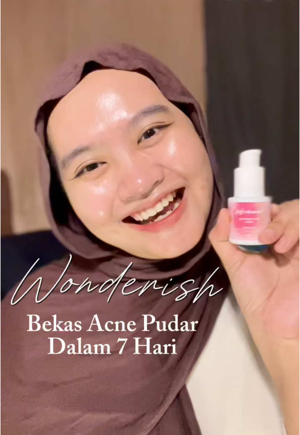 Hallo gais yang punya masalah bekas acne kaya aku ginii cobain deh serum dari @wonderish.id selain dia bisa memudarkan bekas acne jg bisa mencerahkan loh ✨🫶 . . . . . tags : #wonderish #wonderishserum #cerahlebihcepat #mencerahkan #brightening #formofselflove #reviewwonderish #wondersilkybrighteningserum #niacinamide #skincare #rekomendasiskincare #irishbella #brighteningserum  @wonderish.official #Adoteumhabitinho 