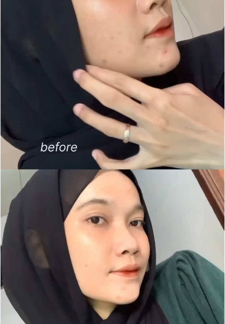 gausah diraguin lagi ga sih semua produk dari @msglow.beauty  #msglow #msglowskincare #msglowbeauty #skincareroutine #maxi #maxiroyalcelixir 