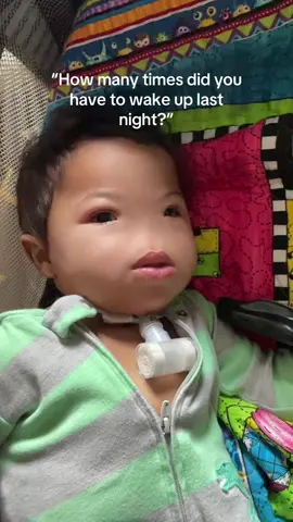 Trẻ sơ sinh có thể không có mũi do một tình trạng hiếm gặp gọi là arhinia bẩm sinh. Tình trạng này, còn được gọi là Hội chứng vi thể mắt Bosma Arhinia (BAMS), được đặc trưng bởi việc không có mũi ngoài và cũng có thể ảnh hưởng đến mắt và tuổi dậy thì. Arhinia bẩm sinh cực kỳ hiếm, chỉ có khoảng 40-50 trường hợp được ghi nhận trên toàn thế giới.
