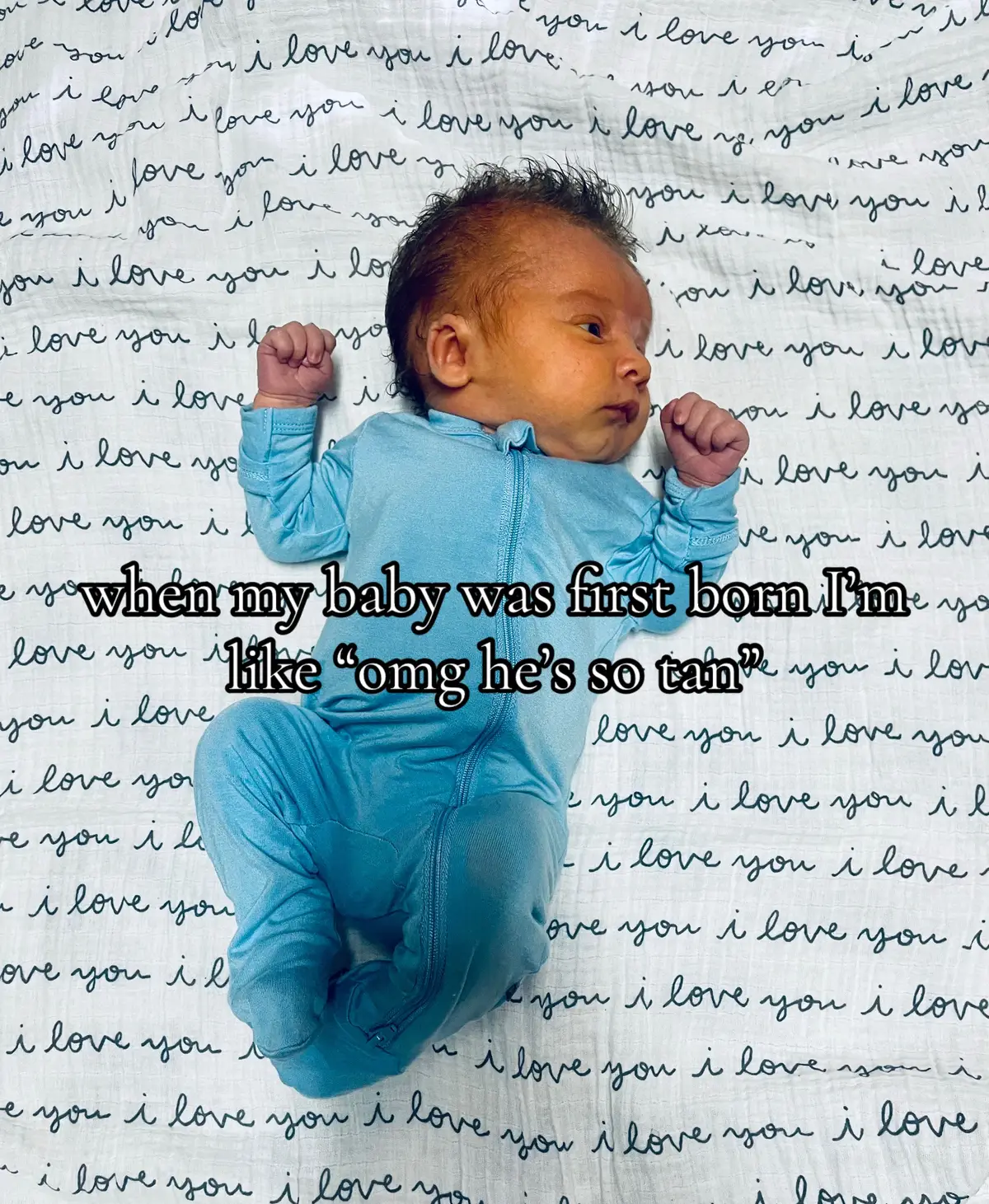 #jaundice #babyboy #fyp #relatable #boymom 