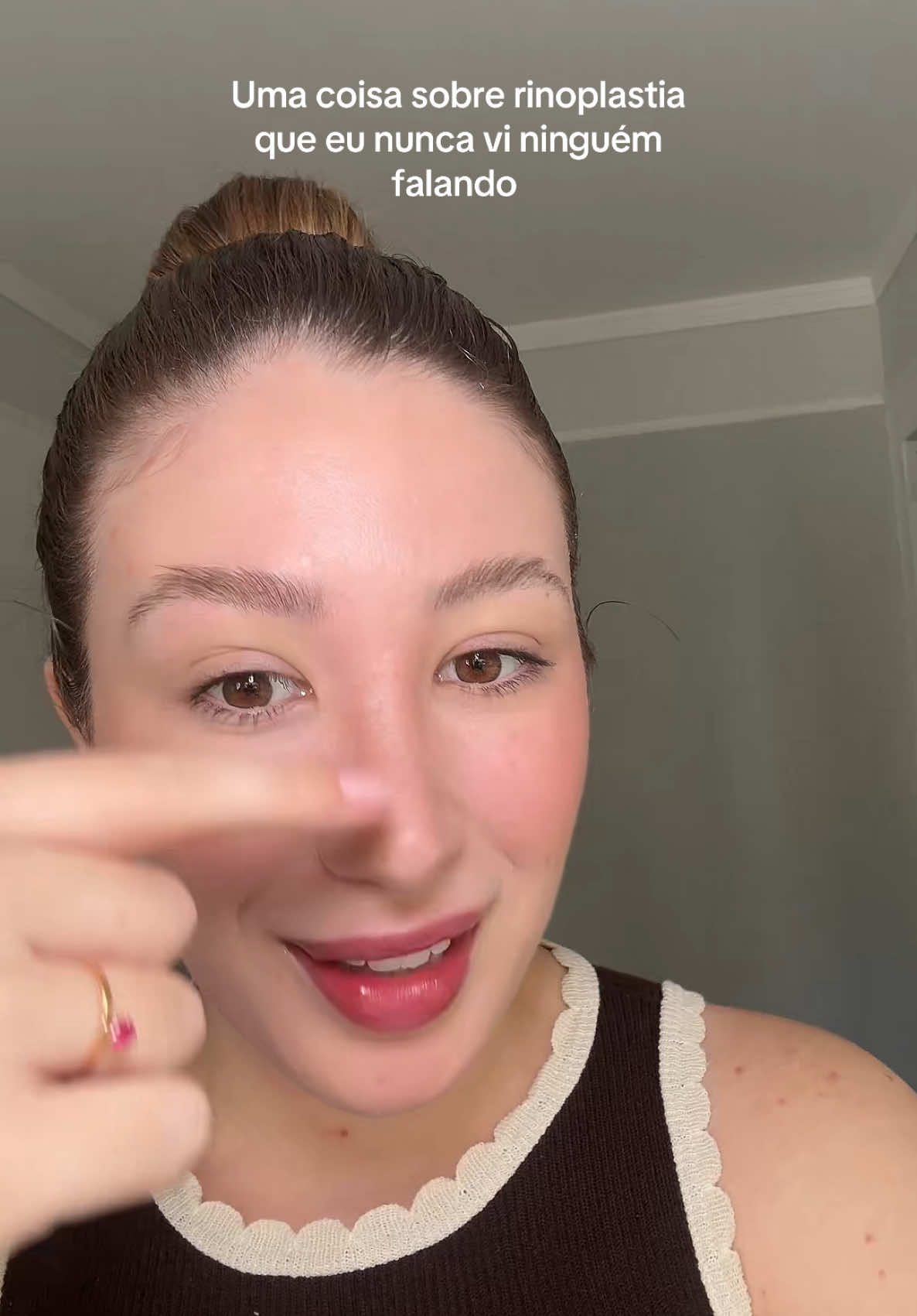 Eu AMO minha rinoplastia, mas na época isso me pegou 🤧😂 #rinoplastia #plastic #relatos