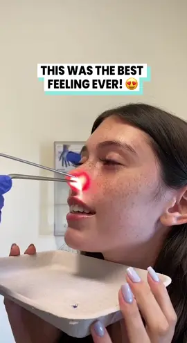 Ver satisfying @vstell #fyppp #nosejob #satisfyingvideo  This was the best feeling ever